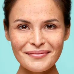 Biodermal P-CL-E Serum 30 ml