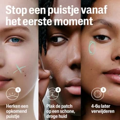 Cetaphil Puistjespleisters 6 uur 24 stuks