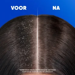 Head & Shoulders Shampoo Classic 300 ml