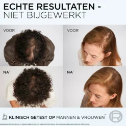 L'Oréal Elvive Fiber Booster Anti-Haaruitval Conditioner 150 ml