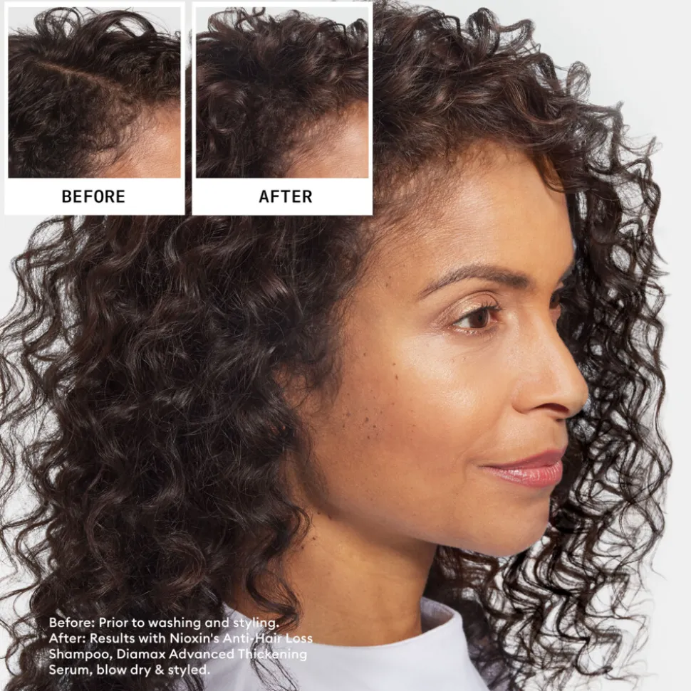 Nioxin Anti-Hairloss Shampoo 240 ml