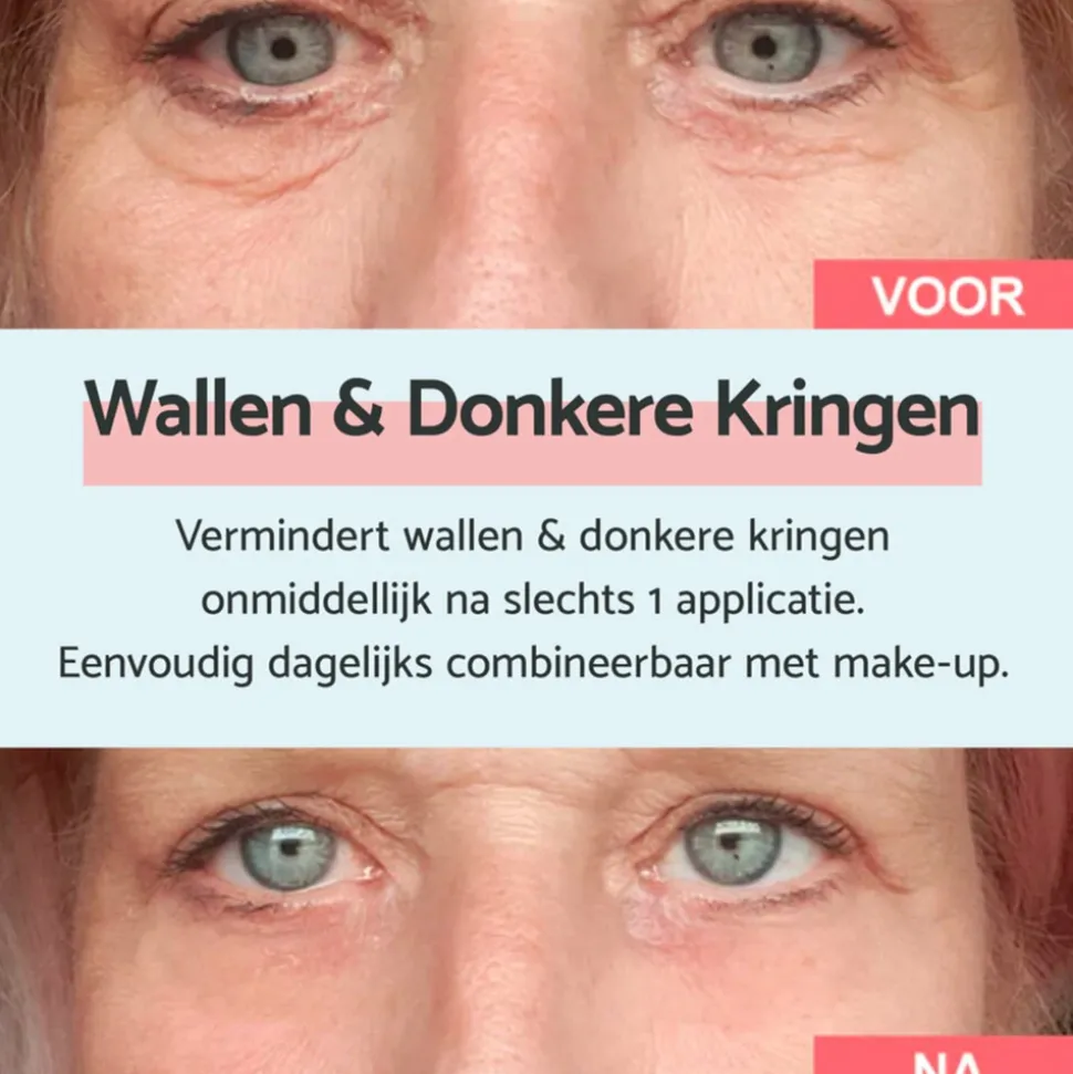 Remescar Oogcrème Wallen en Donkere Kringen 8 ml
