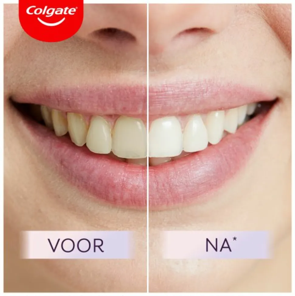 6x Colgate Tandpasta Max White Ultimate 75 ml