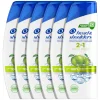 6x Head & Shoulders 2in1 Apple Fresh 300 ml
