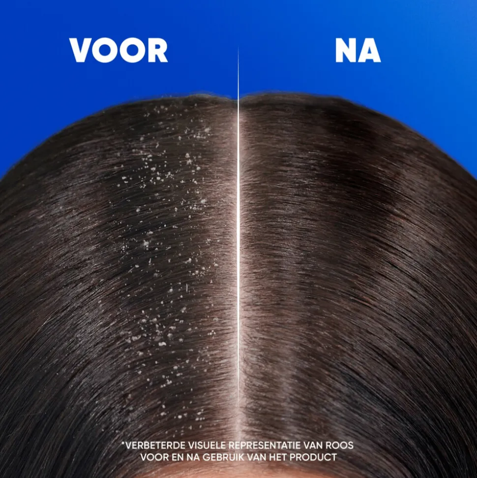 6x Head & Shoulders 2in1 Classic 400 ml