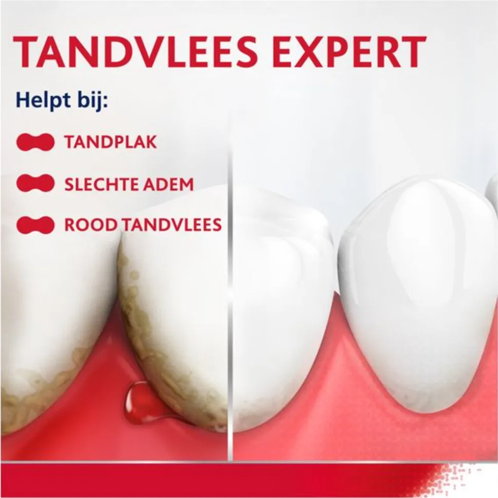 3x Parodontax Tandpasta bij Bloedend Tandvlees Whitening 2 x 75 ml